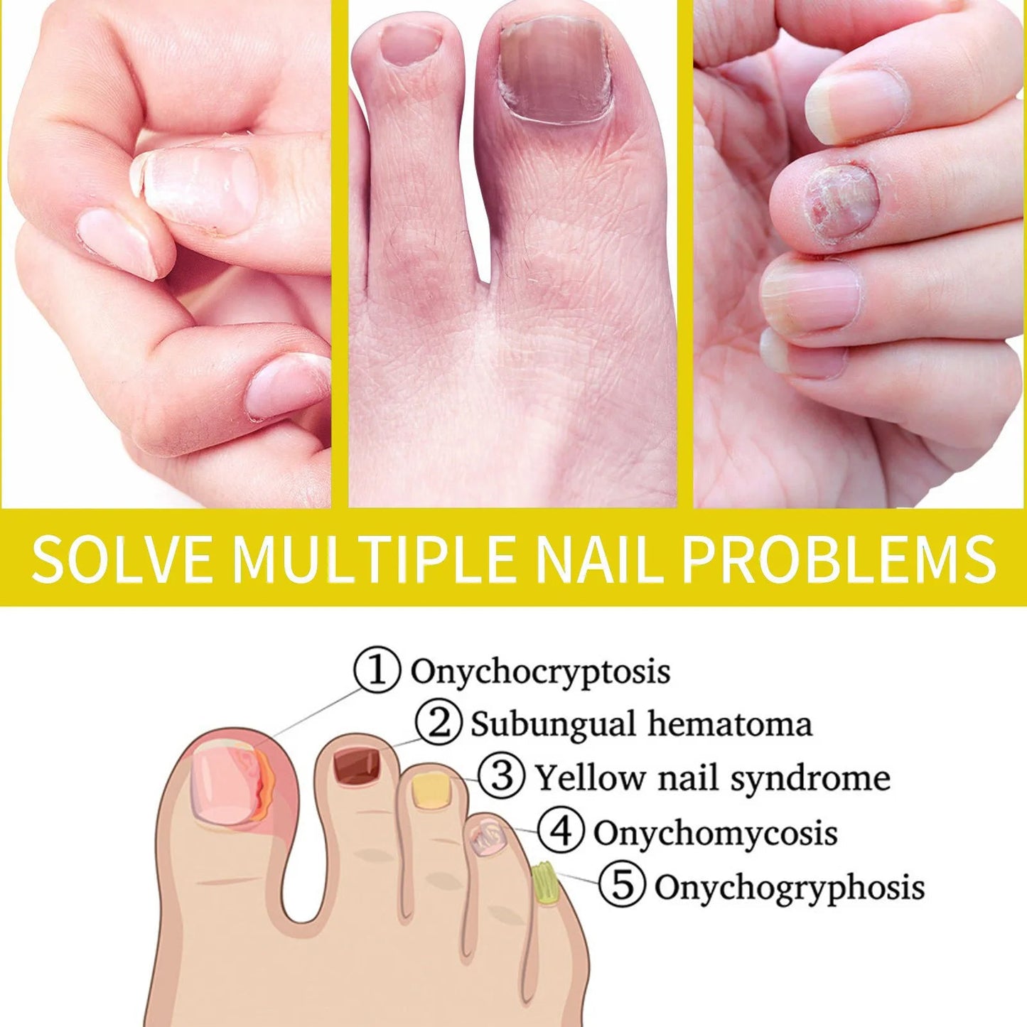 Velora Nail Growth Serum